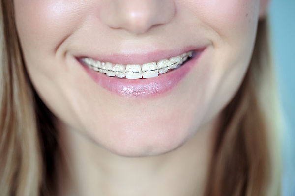 포토 JPG 해외이미지 백인 외관 여자 행복 건강 치과 병원 한명 미소 웃음 사람 치료 10대 뷰티 약 환자 흰색 도자기 입 치아 치과의사 긍정 고정 테라피 돌봄 위생관리 치아교정 구강학 해외202310 해외포토 서양인 1 감정 컬러 컨셉 의학 모션 청소년 표정 관리 신체부위 의사 소화기관 교정 파일형식