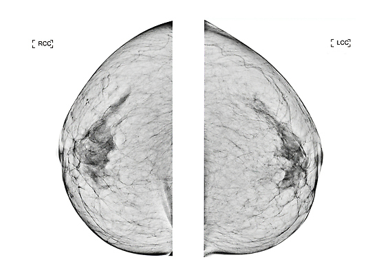 포토 JPG 해외이미지 여자 길 건강 병원 사람없음 약 시험 환자 성장 수비 오르간 질병 가슴 자르기 확인 예방 암 외과 의심 방사선 탐지 해외202310 해외포토 교육 감정 의학 모션 사람 신체부위 건반악기 파일형식