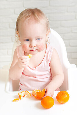 포토 JPG 해외이미지 백인 얼굴 어린이 음식 건강 한명 사람 빨간색 약 고통 흰색 아기 점 질병 피부 감염 토막 알레르기 돌봄 반응 증상 해외202310 해외포토 서양인 1 감정 컬러 의학 모션 신체부위 파일형식