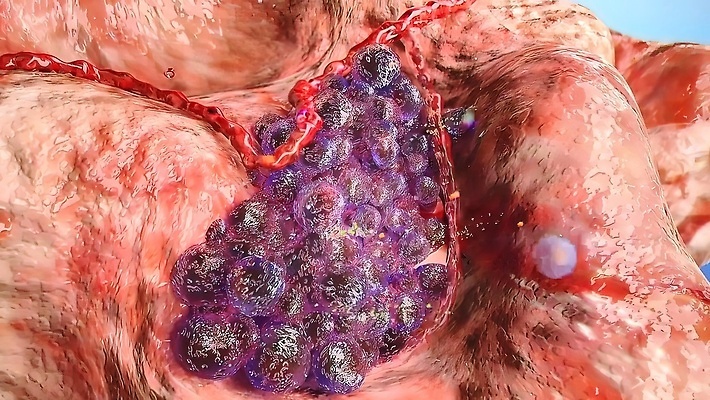포토 JPG 해외이미지 과학 모션 사람없음 가로 빨간색 컬러풀 약 3D 성장 원형 바이러스 확대 질병 묘사 생물학 미생물 문제 암 개발 구성 종양 락다운 해외202310 해외포토 도형 교육 컬러 의학 생물 디지털합성 파일형식