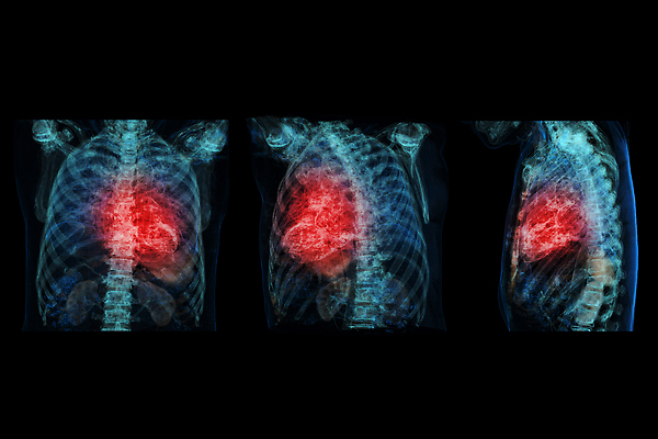 포토 JPG 해외이미지 남자 일러스트 스트레스 건강 사람 성인 사람없음 약 3D 고통 심장 긴급 맥박 호흡 질병 상처 공격 문제 동맥 궤 돌봄 타격 해로움 해외202310 해외포토 감정 컨셉 의학 모션 장기_의학 디지털합성 혈관 파일형식