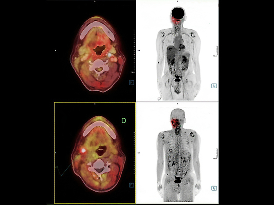 포토 JPG 해외이미지 과학 신체 골격 병원 사람없음 반려동물 약 기계 장비 시험 과학기술 환자 의사 뇌 퓨전 두통 목 암 방사능 방사선 스캐너 해외202310 해외포토 동물 교육 의학 기술 신체부위 의료진 질병 파일형식