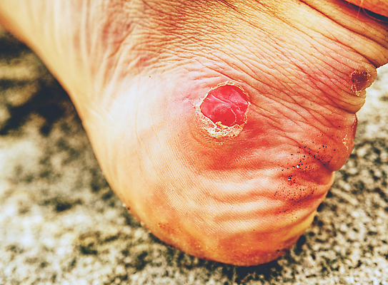 포토 JPG 해외이미지 백인 남자 여행 백그라운드 발 휴가 천사 피곤 한명 걷기 골짜기 하이킹 고통 탐험 가을 붓 가장자리 떨어짐 위험 자르기 기적 모험가 피부 언덕 오르기 발목 건너기 깊이 돌봄 하이커 화상 해외202310 해외포토 서양인 1 계절 감정 컨셉 모션 자연 레저 사람 신체부위 둘레 상처 파일형식