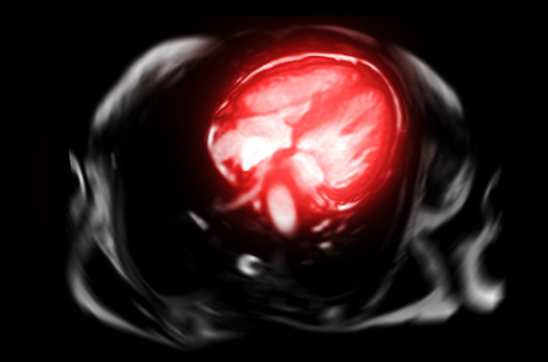 포토 JPG 해외이미지 엑스레이 건강 사람없음 그래픽 환자 심장 맥박 질병 공격 회의실 순환 함선 동맥 궤 돌봄 방사선 심장병 타격 해외202310 해외포토 배_교통 의학 모션 장기_의학 혈관 파일형식