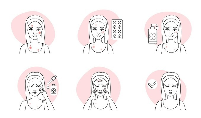 EPS 해외이미지 얼굴 선 음식 일러스트 표면 건강 병원 치료 세트 뷰티 알약 약 검은색 화장품 인포그래픽 의사 지성 껍질 얼룩 변화 질병 피부 크림 피부관리 윤곽 문제 여드름 순서 돌봄 얇은 염증 위생관리 전후 벡터 해외202310 해외일러스트 컬러 컨셉 의학 모션 관리 신체부위 의료진 비교 파일형식