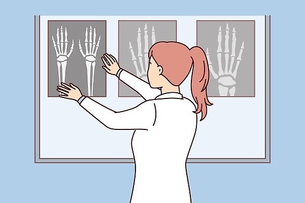 EPS 해외이미지 손 여자 일러스트 뼈 엑스레이 건강 한명 성인 의사 성인여자한명만 해외202309 해외일러스트 1 의학 사람 신체부위 의료진 여자한명만 성인여자만 파일형식 벡터