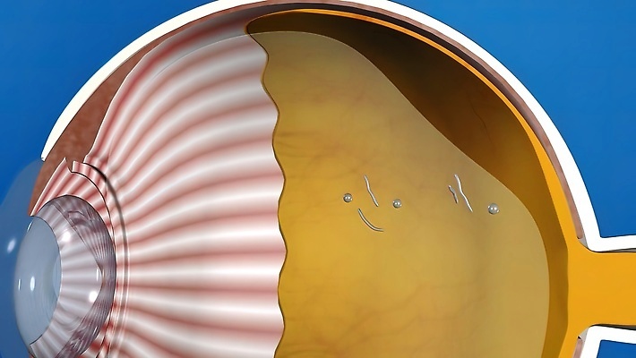 포토 JPG 해외이미지 교육 과학 일러스트 해부 건강 사람 사람없음 약 폭포 의사 조직 질병 눈동자 생물학 시력 비전 붓꽃 안과 시력검사 당뇨병 블러 시각장애인 광학 검안사 해외202310 해외일러스트 직업 꽃 의학 자연 병원 의료진 눈_신체부위 장애인 검사_조사 파일형식 안경사