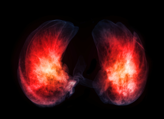 포토 JPG 해외이미지 과학 백그라운드 해부 엑스레이 건강 병원 사람 사람없음 3D 환자 심장 투명 오르간 허파 질병 흉부 주사약 동맥 궤 방사선 심장병 해외202310 해외포토 의학 약 장기_의학 건반악기 호흡기관 디지털합성 혈관 파일형식