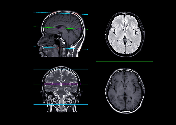 포토 JPG 해외이미지 과학 해부 건강 병원 사람없음 약 머리 시험 질병 분석 뇌 두통 자석 방사선 스캐너 스캔 치매 타격 패닝샷 해골모형 코로나바이러스 해외202310 해외포토 교육 컨셉 의학 모션 촬영기법 신체부위 모형 바이러스 파일형식
