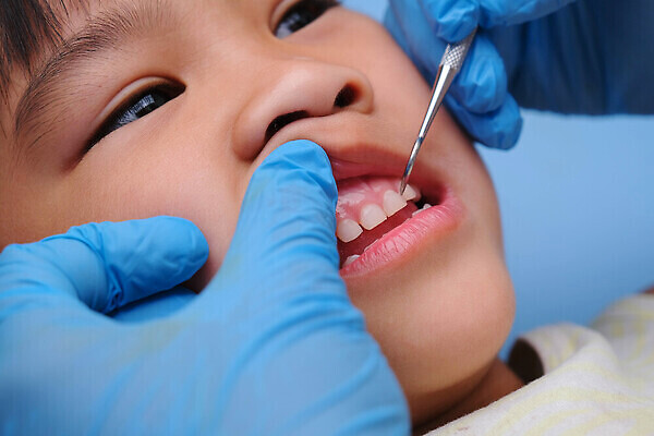 포토 JPG 해외이미지 여자 어린이 백그라운드 건강 치과 병원 한명 사람 치료 약 거울 장비 성장 흰색 공구 오픈 입 치아 혀 입술 치과의사 보여주기 턱 최초 개발 돌봄 위생관리 잇몸 해외202310 해외포토 1 컬러 신체 의학 모션 관리 신체부위 의사 도구 소화기관 파일형식