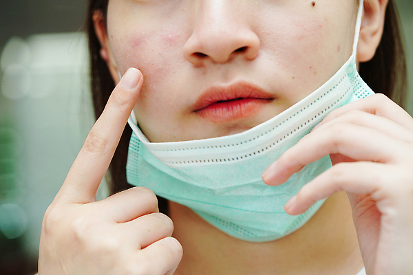 포토 JPG 해외이미지 여자 아시아 얼굴 건조 건강 한명 동양인 치료 빨간색 뷰티 약 화장품 점 기름 질병 상품 피부 피부관리 감염 문제 반대 여드름 돌봄 사춘기 위생관리 이마 흉터 못생김 해외202310 해외포토 1 나라 음식 컬러 의학 모션 관리 사람 인종 신체부위 상처 파일형식