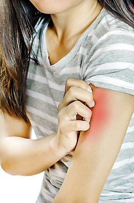 포토 JPG 해외이미지 손 여자 손가락 건조 건강 한명 치료 약 고통 질병 손목 피부 문제 팔 테라피 토막 알레르기 연소 곰팡이 돌봄 모기 염증 증상 치료제 의료성형뷰티 해외202004 해외포토 1 감정 의학 모션 사람 신체부위 뷰티 해충 파일형식