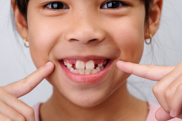 포토 JPG 해외이미지 행복 얼굴 어린이 백그라운드 요정 실내 건강 치과 병원 한명 미소 웃음 사람 가로 뷰티 우유 붓 입 구멍 변화 치아 치과의사 긍정 쇼 보여주기 위생관리 적자 실종 해외202310 해외포토 1 감정 컨셉 의학 모션 유제품 표정 관리 내부 신체부위 의사 소화기관 사건 파일형식