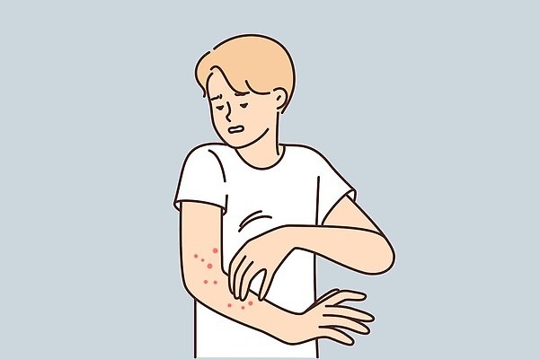 EPS 해외이미지 남자 일러스트 한명 성인 환자 짜증 피부관리 여드름 두드러기 습진 성인남자한명만 긁기 해외202310 해외일러스트 1 감정 의학 모션 사람 뷰티 알레르기 피부질환 남자한명만 성인남자만 파일형식 벡터