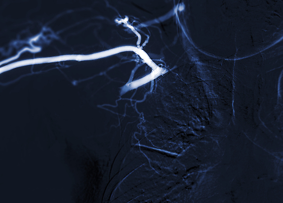 포토 JPG 해외이미지 과학 기술 건강 병원 사람 사람없음 치료 약 고통 장비 환자 의사 수술 수리 질병 철사 풍선 지휘자 주사약 동맥 방법 방사선 살균 해외202310 해외포토 감정 의학 음악가 의료진 혈관 파일형식
