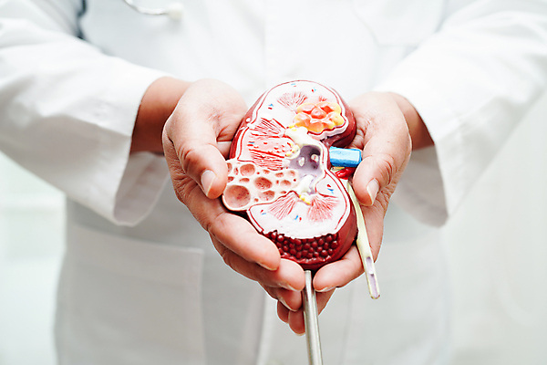 포토 JPG 해외이미지 건강 한명 상반신 성인 모형 의사 잡기 신장 질병 증상 성인한명만 해외202310 해외포토 1 의학 모션 사람 의료진 비뇨기관 성인만 파일형식