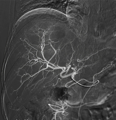 포토 JPG 해외이미지 세포 엑스레이 건강 병원 사람없음 약 장비 환자 의사 긴급 수술 선택 질병 위험 간 시트 외과 덩어리 동맥 방사선 복근 종양 해외202310 해외포토 컨셉 의학 근육 치료 의료진 장기_의학 혈관 파일형식