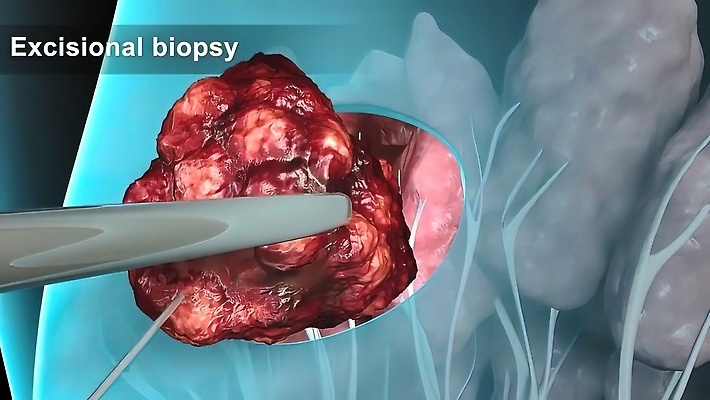 포토 JPG 해외이미지 여자 음료 과학 신체 일러스트 해부 건강 사람 사람없음 그래픽 약 지구본 3D 건강관리 냉동 추위 의사 죽음 신선 질병 위험 시원함 가슴 크리스탈 큐브 생물학 분열 암 외과 테라피 췌장 고립 종양 해외202310 해외일러스트 교육 컨셉 의학 병원 관리 신체부위 뷰티 의료진 장기_의학 광석 디지털합성 파일형식