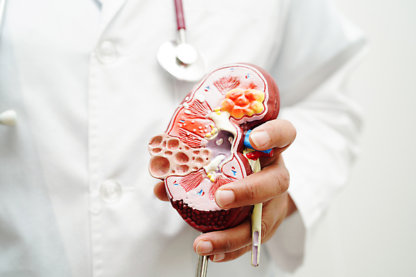 포토 JPG 해외이미지 건강 한명 상반신 성인 모형 의사 잡기 신장 질병 증상 성인한명만 해외202310 해외포토 1 의학 모션 사람 의료진 비뇨기관 성인만 파일형식