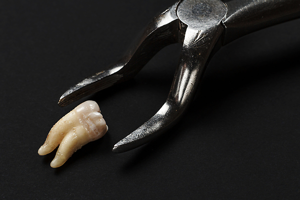 포토 JPG 해외이미지 직업 치과 병원 손잡이 사람없음 치료 약 금속 장비 기구 도구 공구 치아 치과의사 각도 펜치 외과 복원 위생관리 직진 철강 치아교정 해외202310 해외포토 의학 재질 관리 의사 소화기관 교정 파일형식