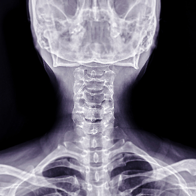 포토 JPG 해외이미지 과학 신체 해부 뼈 골격 흑백 건강 사람 사람없음 약 고통 시험 환자 의사 흰색 질병 상처 X 척추 관절염 목 C 고립 염증 정형외과 해골모형 해외202310 해외포토 알파벳 교육 감정 컬러 의학 촬영기법 병원 신체부위 모형 의료진 파일형식