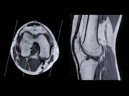포토 JPG 해외이미지 스포츠 근육 뼈 골격 엑스레이 건강 병원 사람없음 약 건강관리 고통 시험 의사 광선 필름 확인 무릎 자석 깨짐 스캐너 연골 정형외과 해외202310 해외포토 교육 감정 컨셉 의학 관리 신체부위 의료진 파일형식