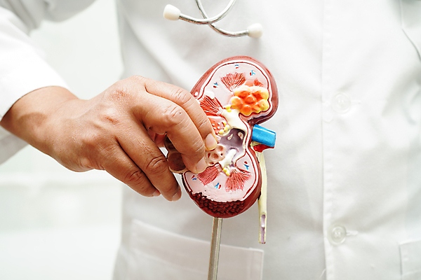 포토 JPG 해외이미지 건강 한명 상반신 성인 모형 의사 잡기 신장 질병 증상 성인한명만 해외202310 해외포토 1 의학 모션 사람 의료진 비뇨기관 성인만 파일형식