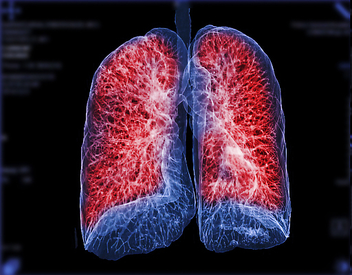 포토 JPG 해외이미지 직업 과학 일러스트 부분 해부 병원 사람 사람없음 컴퓨터 약 3D 스크린 환자 의사 오르간 호흡기관 질병 흉부 필름 감시 시스템 암 궤 방사선 심장병 천식 해외202310 해외포토 의학 전자제품 의료진 장기_의학 건반악기 디지털합성 파일형식