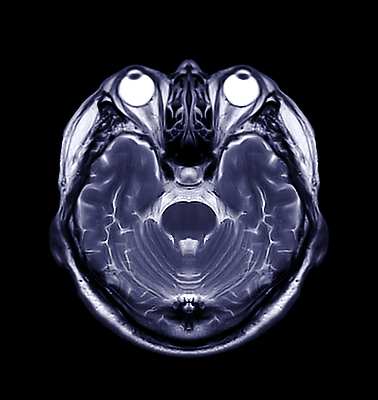 포토 JPG 해외이미지 엑스레이 건강 병원 사람없음 치료 약 머리 고통 환자 질병 뇌 함선 두통 동맥 방사선 종양 타격 해골모형 혼란 해외202310 해외포토 감정 컨셉 배_교통 의학 모션 신체부위 모형 혈관 파일형식