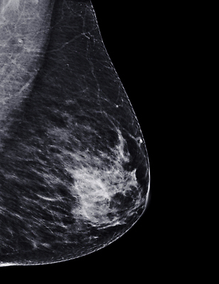 포토 JPG 해외이미지 여자 건강 병원 사람없음 디지털 시험 환자 의사 성장 수비 오르간 질병 가슴 확인 예방 유방암 암 외과 의심 방사선 탐지 해외202310 해외포토 교육 감정 의학 모션 사람 신체부위 의료진 건반악기 파일형식