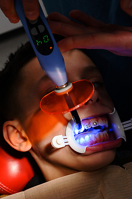 포토 JPG 해외이미지 직업 얼굴 의료기기 건강 한명 치료 빛 약 장비 시험 환자 의사 공구 표현 입 치아 청소 입술 치과의사 돌봄 위생관리 자외선 접착제 치아교정 해외202310 해외포토 1 교육 의학 모션 관리 사람 신체부위 의료진 도구 소화기관 풀_접착제 교정 파일형식