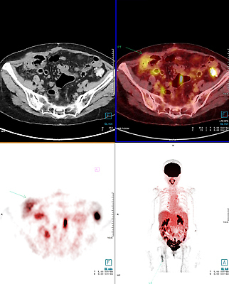 포토 JPG 해외이미지 백그라운드 신체 사람없음 암 궤 돌봄 해외202310 해외포토 모션 질병 파일형식
