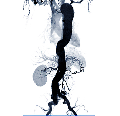 포토 JPG 해외이미지 컬러 백그라운드 일러스트 해부 건강 병원 사람 사람없음 그래픽 치료 약 3D 장비 환자 투명 비교 오르간 질병 공격 함선 동맥 궤 복근 스캐너 심장병 가상 해외202310 해외일러스트 컨셉 배_교통 의학 모션 근육 건반악기 디지털합성 혈관 파일형식
