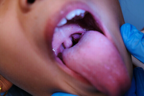 포토 JPG 해외이미지 여자 어린이 백그라운드 건강 치과 한명 사람 치료 뷰티 약 성장 흰색 아기 오픈 입 치아 혀 입술 치과의사 보여주기 턱 최초 개발 돌봄 위생관리 잇몸 줄서기 해외202310 해외포토 1 컬러 신체 의학 모션 병원 관리 신체부위 의사 소화기관 파일형식