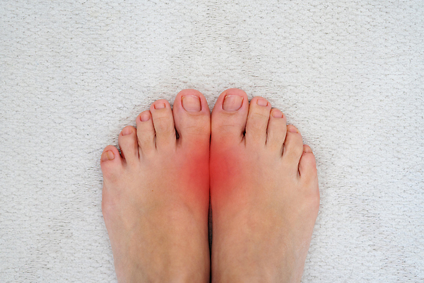 포토 JPG 해외이미지 여자 백그라운드 손가락 발 뼈 건강 사람 사람없음 빨간색 약 고통 환자 점 질병 상처 큼 관절염 문제 발가락 돌봄 부담 양발 염증 정형외과 강조 해외202310 해외포토 손 감정 컬러 의학 모션 병원 신체부위 크기 파일형식