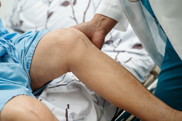 포토 JPG 해외이미지 여자 노년 신체 해부 건강 병원 사람 성인 사람없음 치료 약 금속 검은색 고통 환자 긴급 수술 닫기 질병 상처 위험 자르기 은퇴 간호 피부 관절염 땀 무릎 골다공증 섬유 외과 테라피 교체 돌봄 절개 치유 흉터 해외202310 해외포토 감정 컬러 컨셉 의학 모션 재질 신체부위 뷰티 직물 파일형식