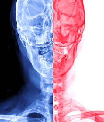 포토 JPG 해외이미지 해부 뼈 골격 흑백 건강 사람 사람없음 약 고통 시험 환자 의사 질병 상처 X 척추 관절염 목 C 고립 염증 정형외과 지도책 해골모형 해외202310 해외포토 알파벳 교육 감정 의학 촬영기법 병원 신체부위 책 모형 의료진 파일형식