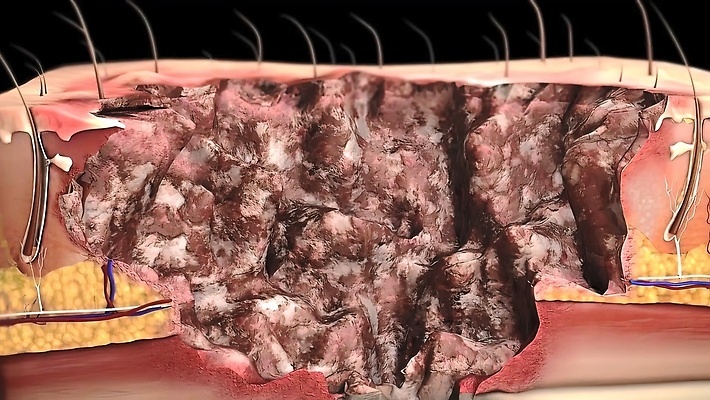 포토 JPG 해외이미지 손 디자인 신체 건조 미술 사람 사람없음 빨간색 물 태양 약 3D 고통 환자 짜증 조직 질병 피부 생물학 감염 문제 암 토막 알레르기 돌봄 반응 염증 증상 화상 못생김 해외202310 해외포토 자연요소 교육 감정 컬러 의학 모션 문화예술 신체부위 상처 디지털합성 파일형식