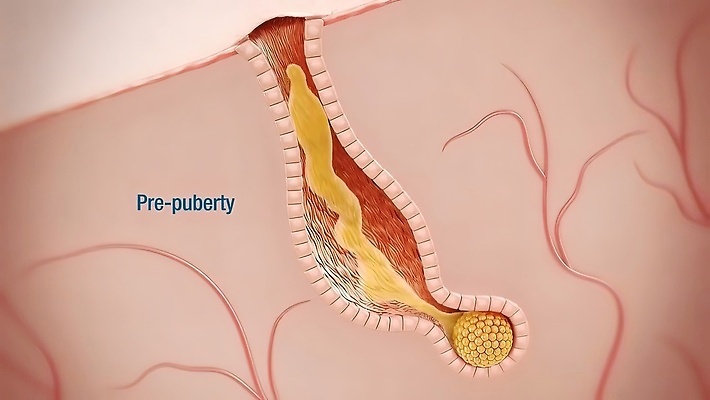 포토 JPG 해외이미지 모델 여자 얼굴 일러스트 청소년 돋보기 세포 건강 사람 사람없음 치료 10대 뷰티 약 인포그래픽 무대 짜증 신선 점 얼룩 불안 피부 입술 그림 감염 문제 테라피 박테리아 여드름 돌봄 사춘기 염증 이마 못생김 해외202310 해외포토 감정 의학 모션 신체부위 질병 파일형식