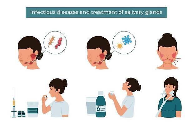 EPS 해외이미지 여자 얼굴 신체 일러스트 해부 건강 사람 치료 세트 약 인포그래픽 고통 입 오르간 플랫 바이러스 질병 감염 전염 테라피 물리치료 염증 증상 벡터 구내염 해외202310 해외일러스트 감정 의학 신체부위 뷰티 건반악기 파일형식