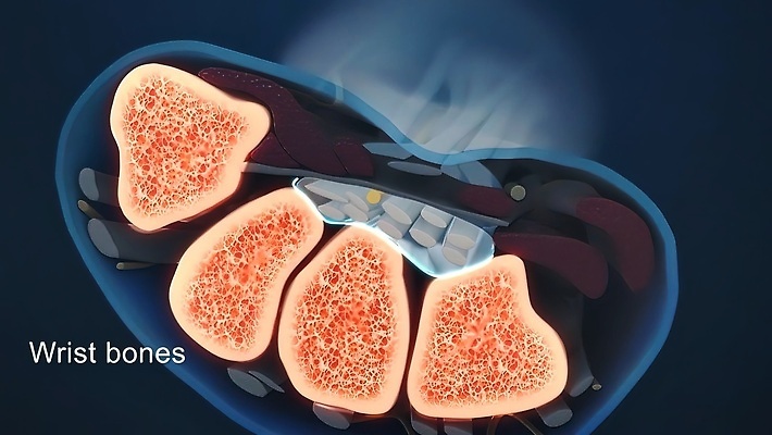 포토 JPG 해외이미지 백인 손 여자 과학 신체 손가락 해부 근육 뼈 골격 건강 사람없음 약 고통 터치 환자 흰색 터널 질병 손목 관절염 문제 팔 외과 테라피 돌봄 압력 해외202310 해외포토 서양인 감정 길 컬러 의학 모션 병원 사람 신체부위 뷰티 파일형식