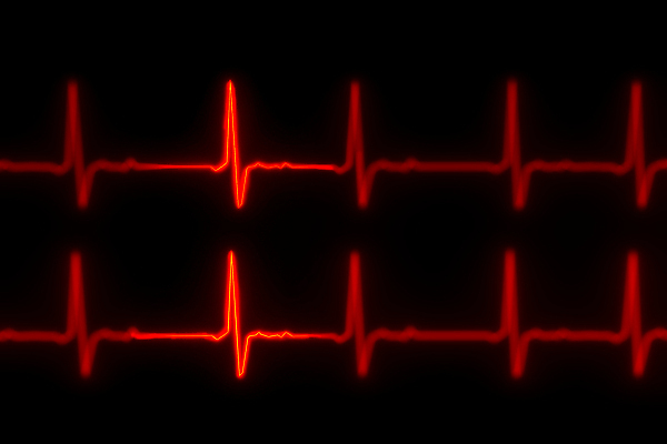 포토 JPG 해외이미지 템플릿 선 파도 백그라운드 패턴 곡선 일러스트 그래프 스트레스 건강 병원 사람 사람없음 그래픽 빨간색 약 모니터 장비 과학기술 심장 긴급 맥박 심볼 분석 속도 네온 감시 돌봄 리듬 심장병 심전도 압력 해외202310 해외일러스트 바다 컬러 컨셉 무늬 의학 모션 기술 컴퓨터 장기_의학 질병 파일형식