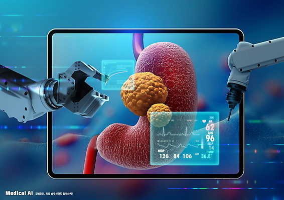 PSD 편집이미지 사람없음 치료 모니터 기계 소화기관 수술 장기 위 암 로봇팔 홀로그램 의료로봇 AI_인공지능 이미지편집 신체 의학 컴퓨터 장기_의학 질병 방향 로봇 파일형식