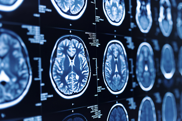 JPG 편집이미지 병원 사람없음 진료 분석 디지털합성 뇌 CT촬영 편집실사 AI포토 AI콘텐츠 컨셉 의학 의료기기 CG 파일형식