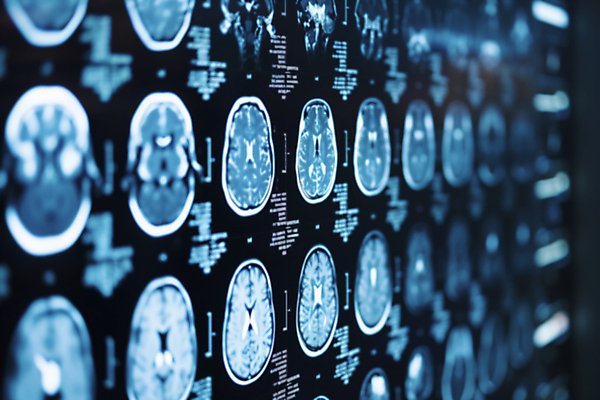 JPG 편집이미지 병원 사람없음 진료 분석 디지털합성 뇌 CT촬영 편집실사 AI포토 AI콘텐츠 컨셉 의학 의료기기 CG 파일형식