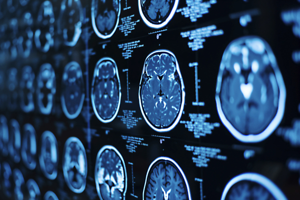 JPG 편집이미지 병원 사람없음 진료 분석 디지털합성 뇌 CT촬영 편집실사 AI포토 AI콘텐츠 컨셉 의학 의료기기 CG 파일형식