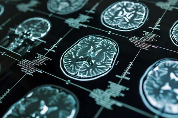 JPG 편집이미지 병원 사람없음 진료 분석 디지털합성 뇌 CT촬영 편집실사 AI포토 AI콘텐츠 컨셉 의학 의료기기 CG 파일형식