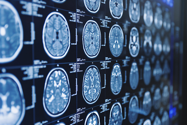 JPG 편집이미지 병원 사람없음 진료 분석 디지털합성 뇌 CT촬영 편집실사 AI포토 AI콘텐츠 컨셉 의학 의료기기 CG 파일형식