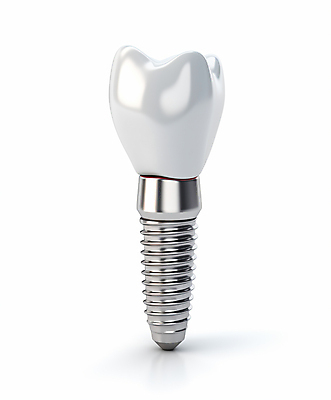 JPG 편집이미지 치과 사람없음 3D 수술 치아 치과용품 시술 치과진료 임플란트 편집3D AI컴퓨터그래픽 AI콘텐츠 의학 병원 치료 진료 의료용품 소화기관 디지털합성 파일형식