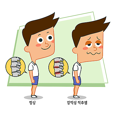 전신 남자 말풍선 일러스트 의학 성인 두명 고통 비교 허리 척추 교정 자세교정 허리디스크 염증 요통 성인남자만 거북목증후군 국내일러스트 AI파일 감정 컨셉 뼈 사람 신체부위 디스크_질병 질병 연습 허리통증 남자만 성인만 파일형식 벡터